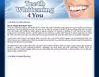 Gallery - Teeth Whitening 4 You Review
