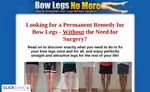 Bow Legs No More Review