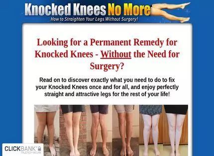 Homepage - Knocked Knees No More Review