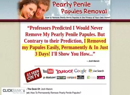 Homepage - Pearly Penile Papules Removal Review