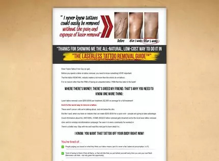 Homepage - The Laserless Tattoo Removal Review