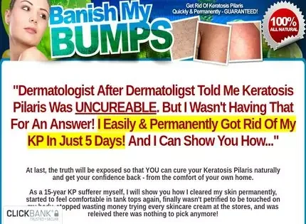 Banish My Bumbs Banish My Bumbs