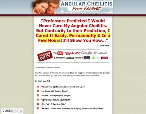 Angular Cheilitis Free Forever