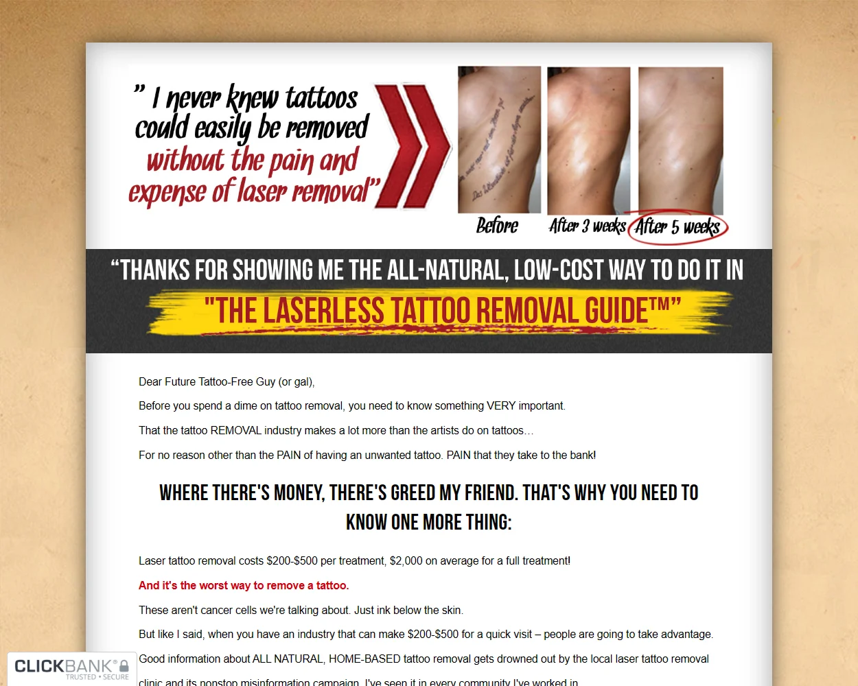 The Laserless Tattoo Removal The Laserless Tattoo Removal